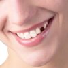 Anestezi Altında Diş Tedavisi Sadece Ameliyathanede Yapılmalı