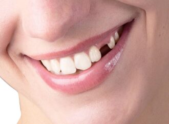 Diş Sağlığında Ömür Boyu Koruma İçin İpuçları